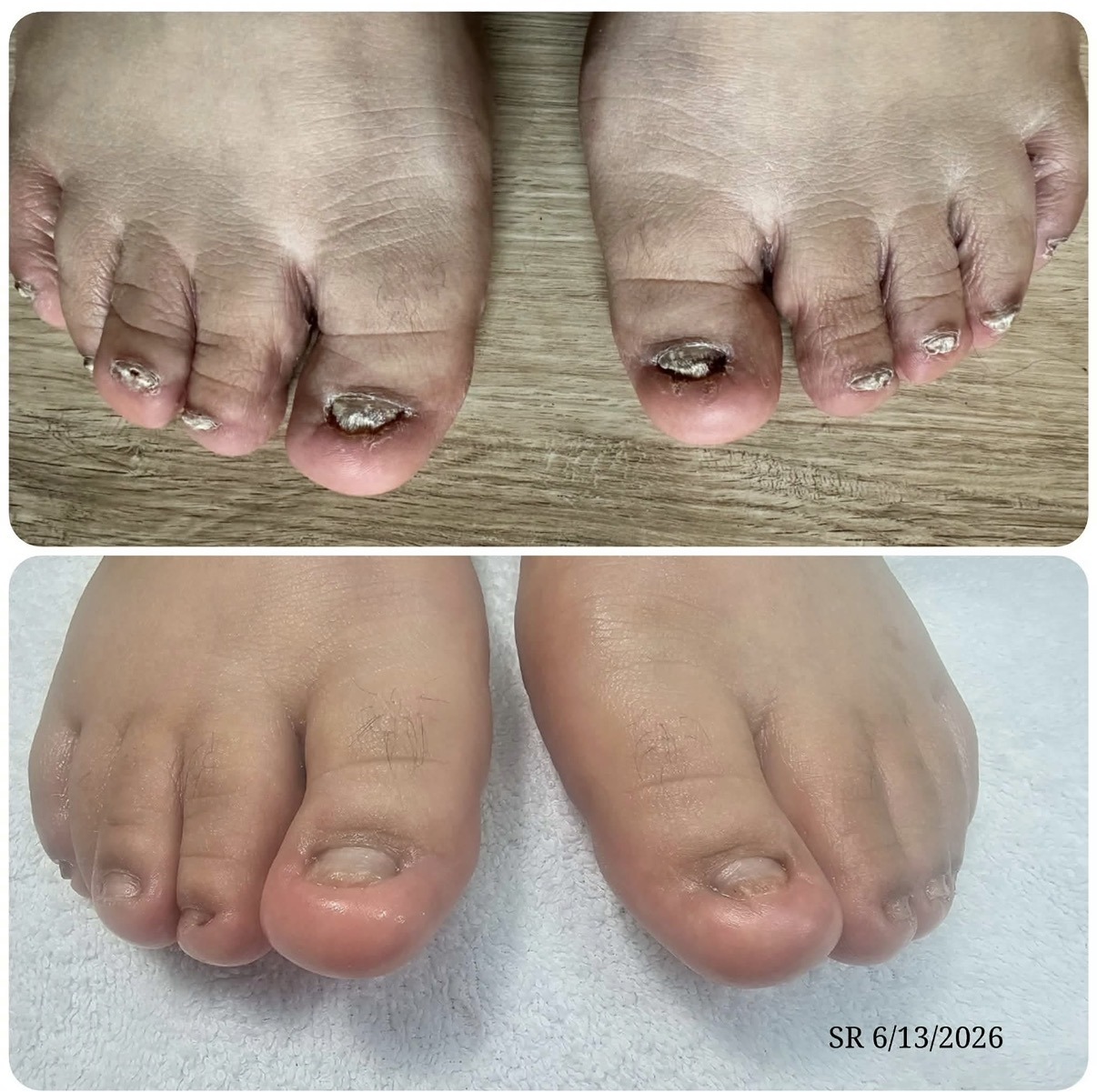 Before client transformation