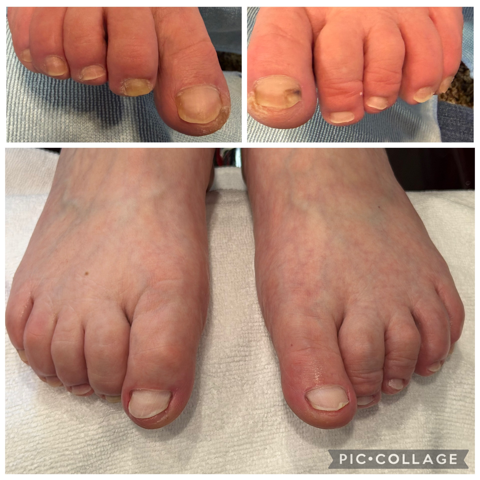 Before client transformation