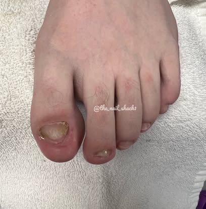 After client transformation